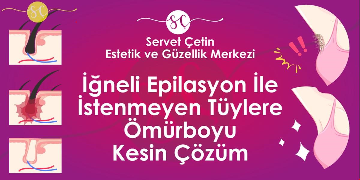 iğneli epilayon